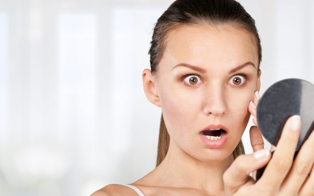 Acne issues? Give your local Charlotte dermatologist a call
