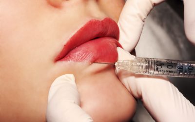 Find the best dermatologist for fillers in south Charlotte NC